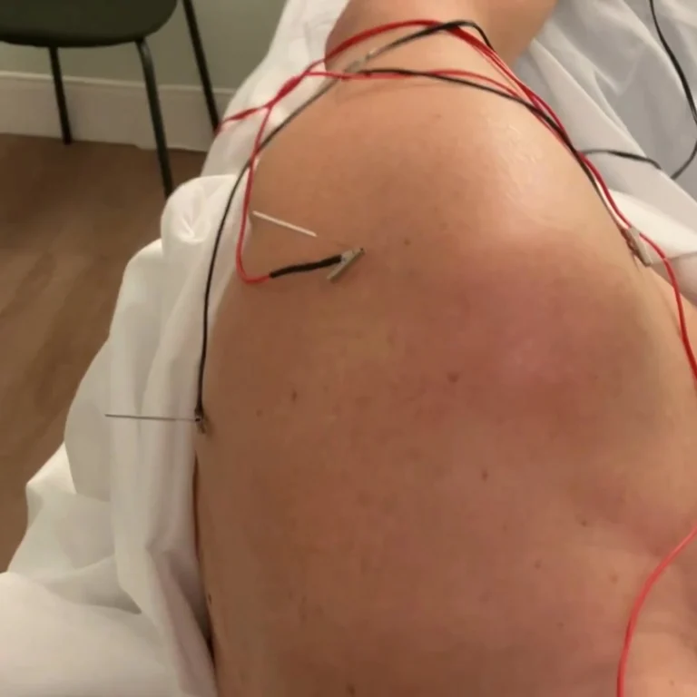 Instagram post from blaiseryan.acupuncture.tcm. This post is in position 0.